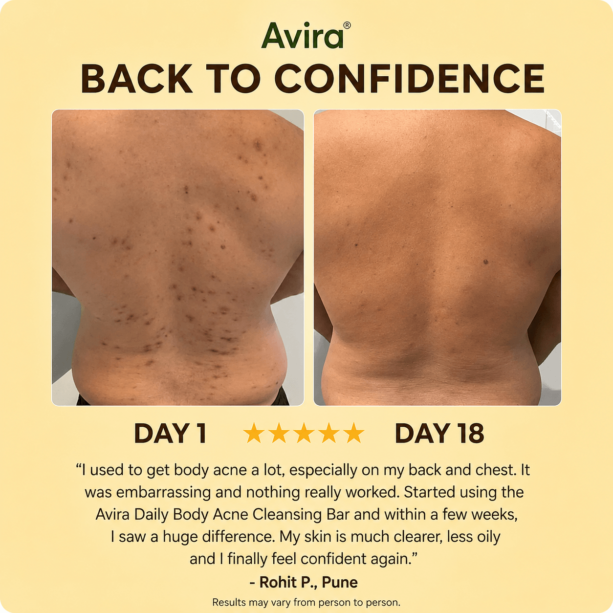 Avira - Body Acne Soap