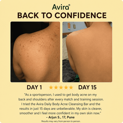 Avira - Body Acne Soap