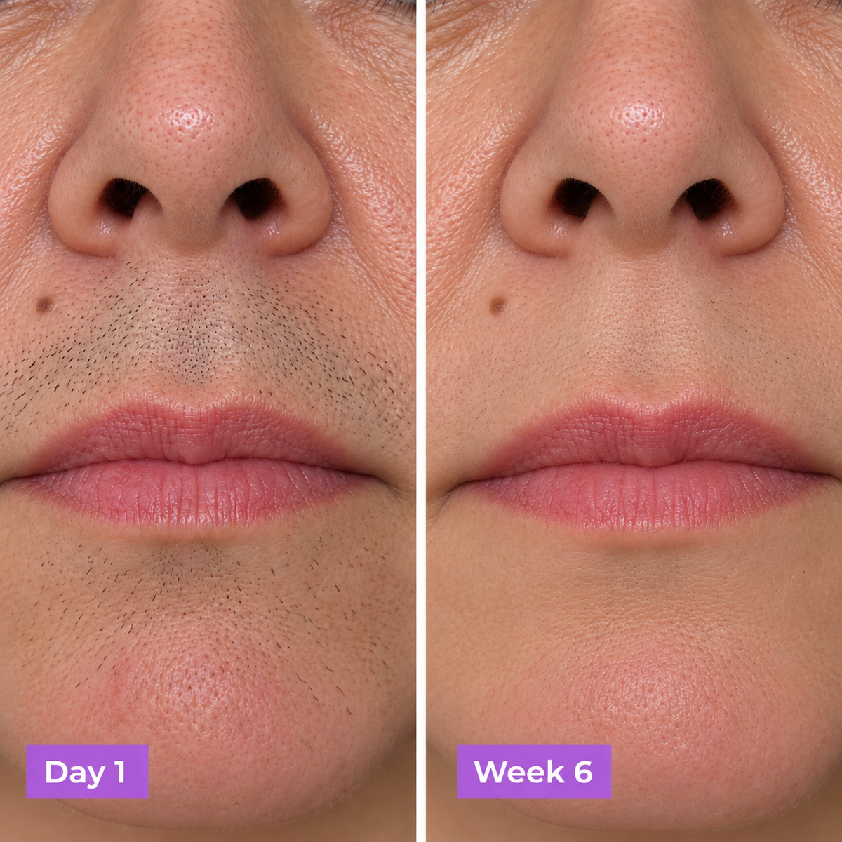 Smoothé - Facial Hair Control Serum